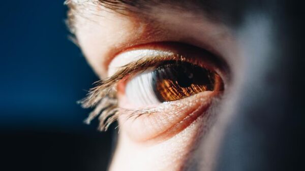 Eyes Care: નાજૂક આંખોને હીટ વેવથી બચાવવા અપનાવો આ ઉપાય...
