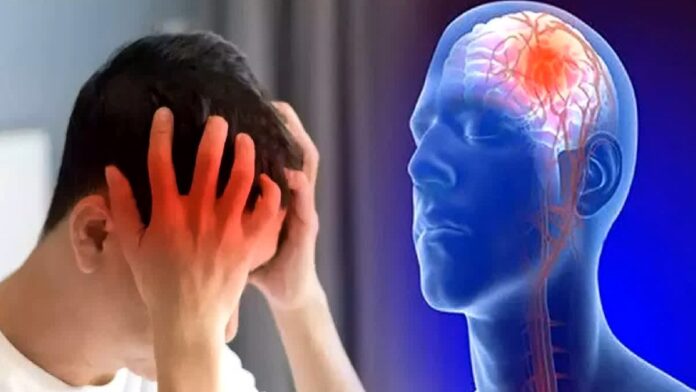 Brain Stroke: વધતા તાપમાનના કારણે સરળતાથી બની શકો છો બ્રેઈન સ્ટ્રોકનો શિકાર, જાણો કેવી રીતે કરશો બચાવ