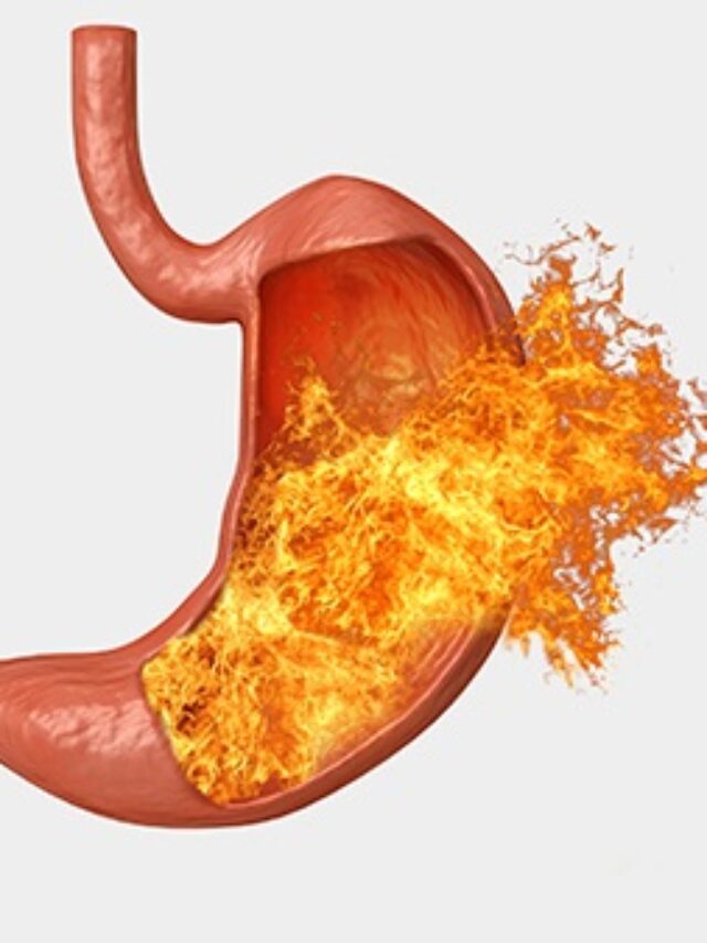 Acidity: એસિડિટી, હાર્ટબર્ન અને પેટમાં દુખાવોથી પરેશાન છો? કરો આ કામ, એસિડ રિફ્લક્સથી મેળશે રાહત