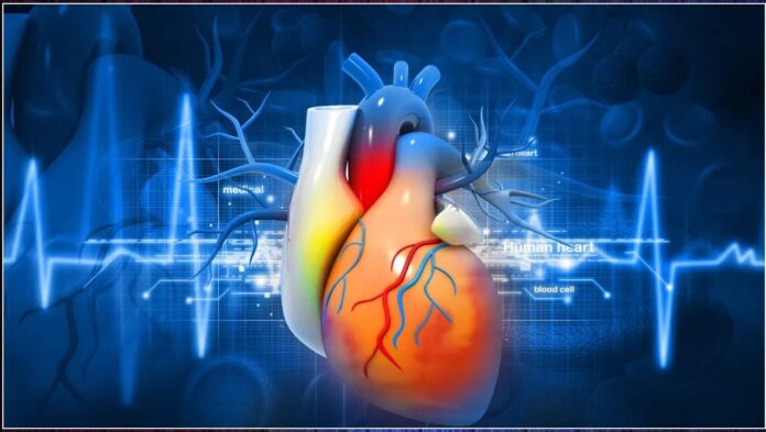 Holiday heart syndrome