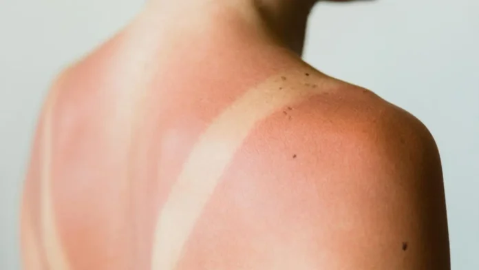 sun tan