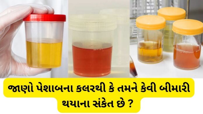 Color of Urine