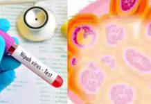 Nipah Virus in West Bengal: પશ્ચિમ બંગાળમાં નિપાહ વાયરસનો ભય: બે શંકાસ્પદ કેસથી હડકંપ, કેન્દ્રની ટીમ તાત્કાલિક તૈનાત Nipah Virus