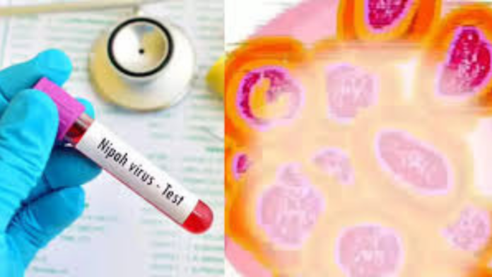 Nipah Virus
