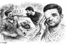 Humanity Shamed in Navapura: માનવતા ભારે પડી! મોપેડ સવારને મદદ કરવા ગયેલા યુવાન પર હુમલો, મુક્કો મારતા ફોટોગ્રાફરે એક આંખની દ્રષ્ટિ ગુમાવી Humanity Shamed in Navapura