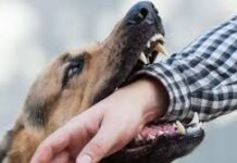 Stray Dog Terror in Surat: સુરતમાં કાળજું કંપાવનારી ઘટના, ૨ વર્ષ બાદ ઈદ મનાવવા વતન જતાં માસૂમ પર ૩ કૂતરાઓનો હિંસક હુમલો, માથું ફાડી નાખ્યું! Stray Dog Terror in Surat