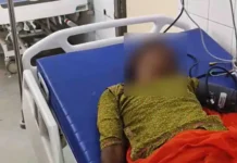 Rare Medical Case: શોકિંગ! નોળિયો કરડ્યા બાદ મહિલાને થયો હડકવા, પાણી જોતાં જ માર્યા તરફડિયા, તબીબો પણ સ્તબ્ધ Rare Medical Case