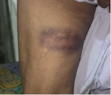 Banaskantha Tensions