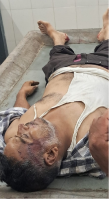 Staged Accident Exposed